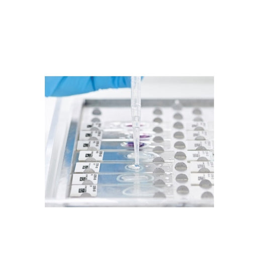 Actin alpha (Smooth Muscle) (SMA), Clone 1A4, 1mL